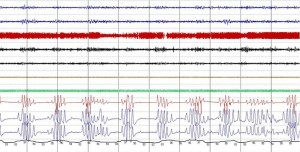 fasi del sonno grafico