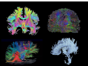 brain scan